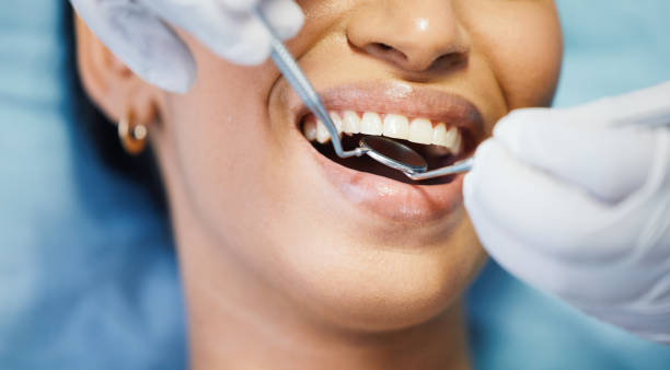 Best Chipped Tooth Repair Near Me  in Garrison, TX